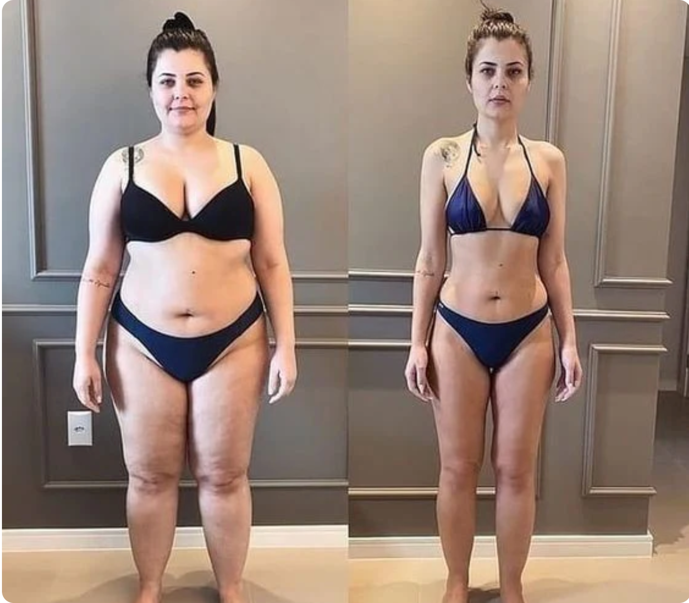 Kit Cerotti Addio Gonfiore Glowria™