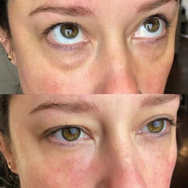 Patch Occhi al Collagene